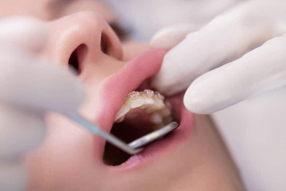 What is Airway-Focused Orthodontics? A Simple Guide for Parents